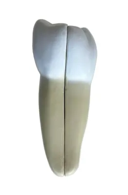 Model INCESIV INFERIOR