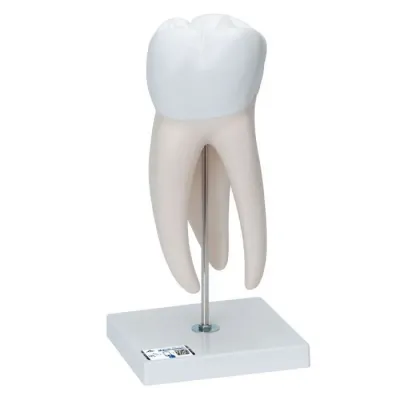 MODEL MOLAR GIGANT CU PREZ CAVITATILOR, X15 , 6 PARTI(3B)