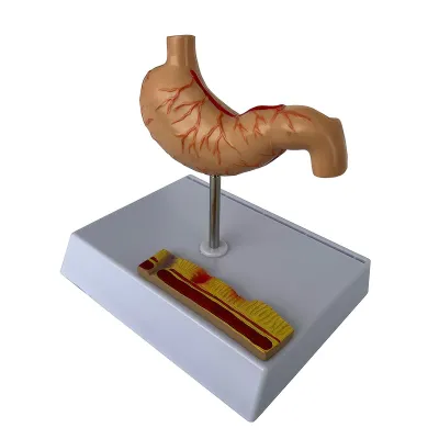 Model STOMAC UMAN  CU ULCER, in sectiune (Q)