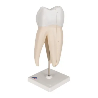 RADACINA MOLAR SUPERIOR INGEMANAT(3B)