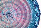 SECTIUNI MICROSCOPICE GIMNOSPERME