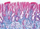 SECTIUNI MICROSCOPICE PASARI SI MAMIFERE