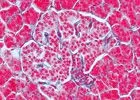 SECTIUNI MICROSCOPICE SISTEMUL ENDOCRIN