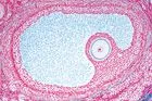 SECTIUNI MICROSCOPICE SISTEMUL GENITAL