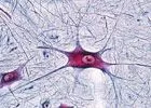 SECTIUNI MICROSCOPICE SISTEMUL NERVOS BSM15